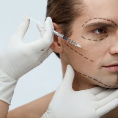 Plastic Surgery. Portrait Of Handsome Young Male With Black Surgical Lines On Face And Doctor's Hand With Syringe Doing Injections In Man's Facial Skin. Beauty Treatment Concept. High Resolution